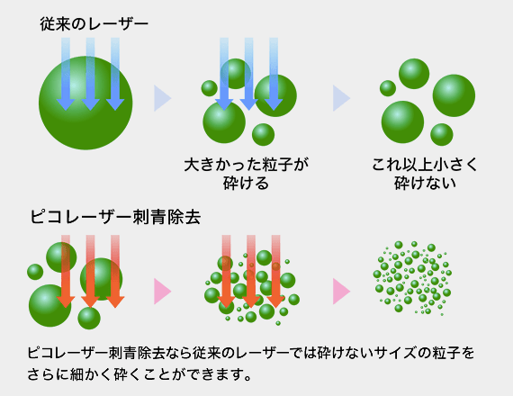 ピコレーザーの特徴を解説